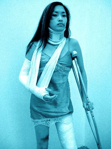 Lena with casts and crutch